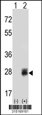 Western blot analysis of his-tag POLR2E (arrow) using his tag antibody. 293T cell lysates (2 ug/lane) either nontransfected (Lane 1) or transiently transfected with the POLR2E gene‘