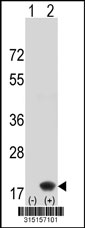 Western blot analysis of his-tag NUDT16 (arrow) using his tag antibody. 293T cell lysates (2 ug/lane) either nontransfected (Lane 1) or transiently transfected with the NUDT16 gene‘