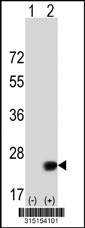 Western blot analysis of his-tag C15orf41 (arrow) using his tag antibody. 293T cell lysates (2 ug/lane) either nontransfected (Lane 1) or transiently transfected with the C15orf41 gene‘