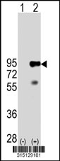 Western blot analysis of his-tag RFX3 (arrow) using his tag antibody. 293T cell lysates (2 ug/lane) either nontransfected (Lane 1) or transiently transfected with the RFX3 gene‘