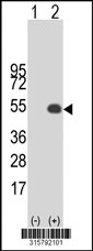 Western blot analysis of his-tag SMAP2 (arrow) using his tag antibody. 293T cell lysates (2 ug/lane) either nontransfected (Lane 1) or transiently transfected with the SMAP2 gene‘