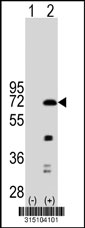 Western blot analysis of his-tag PLOD3 (arrow) using his tag antibody. 293T cell lysates (2 ug/lane) either nontransfected (Lane 1) or transiently transfected with the PLOD3 gene‘