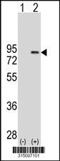 Western blot analysis of his-tag RFX2 (arrow) using his tag antibody. 293T cell lysates (2 ug/lane) either nontransfected (Lane 1) or transiently transfected with the RFX2 gene‘