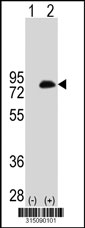 Western blot analysis of his-tag GBE1 (arrow) using his tag antibody. 293T cell lysates (2 ug/lane) either nontransfected (Lane 1) or transiently transfected with the GBE1 gene‘