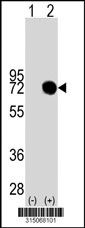 Western blot analysis of his-tag RFX5 (arrow) using his tag antibody. 293T cell lysates (2 ug/lane) either nontransfected (Lane 1) or transiently transfected with the RFX5 gene‘