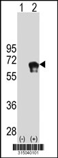 Western blot analysis of his-tag PGM1 (arrow) using his tag antibody. 293T cell lysates (2 ug/lane) either nontransfected (Lane 1) or transiently transfected with the PGM1 gene‘