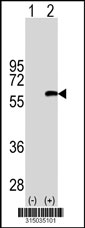 Western blot analysis of his-tag CPNE4 (arrow) using his tag antibody. 293T cell lysates (2 ug/lane) either nontransfected (Lane 1) or transiently transfected with the CPNE4 gene‘