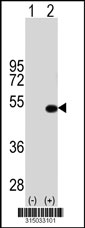 Western blot analysis of his-tag C1orf51 (arrow) using his tag antibody. 293T cell lysates (2 ug/lane) either nontransfected (Lane 1) or transiently transfected with the C1orf51 gene‘