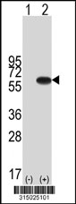 Western blot analysis of his-tag CCDC36 (arrow) using his tag antibody. 293T cell lysates (2 ug/lane) either nontransfected (Lane 1) or transiently transfected with the CCDC36 gene‘