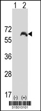 Western blot analysis of his-tag MUS81 (arrow) using his tag antibody. 293T cell lysates (2 ug/lane) either nontransfected (Lane 1) or transiently transfected with the MUS81 gene‘