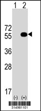 Western blot analysis of his-tag UGDH (arrow) using his tag antibody. 293T cell lysates (2 ug/lane) either nontransfected (Lane 1) or transiently transfected with the UGDH gene‘