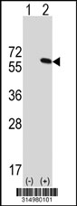 Western blot analysis of his-tag RGS7 (arrow) using his tag antibody. 293T cell lysates (2 ug/lane) either nontransfected (Lane 1) or transiently transfected with the RGS7 gene‘