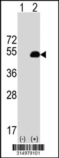 Western blot analysis of his-tag SHMT1 (arrow) using his tag antibody. 293T cell lysates (2 ug/lane) either nontransfected (Lane 1) or transiently transfected with the SHMT1 gene‘