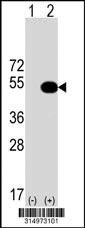 Western blot analysis of his-tag LHX4 (arrow) using his tag antibody. 293T cell lysates (2 ug/lane) either nontransfected (Lane 1) or transiently transfected with the LHX4 gene‘