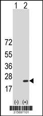 Western blot analysis of his-tag C6orf136 (arrow) using his tag antibody. 293 cell lysates (2 ug/lane) either nontransfected (Lane 2) or transiently transfected with theC6orf136 gene