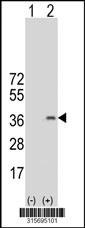 Western blot analysis of his-tag IFI30 (arrow) using his tag antibody. 293 cell lysates (2 ug/lane) either nontransfected (Lane 2) or transiently transfected with theIFI30 gene