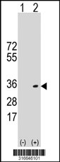 Western blot analysis of his-tag UCP1 (arrow) using his tag antibody. 293T cell lysates (2 ug/lane) either nontransfected (Lane 1) or transiently transfected with the UCP1 gene‘