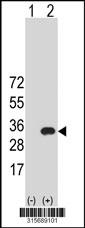 Western blot analysis of his-tag CCDC28B (arrow) using his tag antibody. 293 cell lysates (2 ug/lane) either nontransfected (Lane 2) or transiently transfected with theCCDC28B gene
