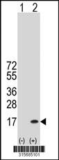 Western blot analysis of his-tag ROBLD3 (arrow) using his tag antibody. 293 cell lysates (2 ug/lane) either nontransfected (Lane 2) or transiently transfected with theROBLD3 gene