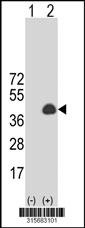 Western blot analysis of his-tag FAM122B (arrow) using his tag antibody. 293 cell lysates (2 ug/lane) either nontransfected (Lane 2) or transiently transfected with theFAM122B gene