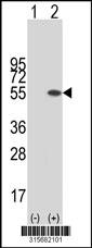 Western blot analysis of his-tag SMARCE1 (arrow) using his tag antibody. 293 cell lysates (2 ug/lane) either nontransfected (Lane 2) or transiently transfected with theSMARCE1 gene