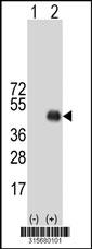 Western blot analysis of his-tag RELL2 (arrow) using his tag antibody. 293 cell lysates (2 ug/lane) either nontransfected (Lane 2) or transiently transfected with theRELL2 gene