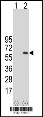 Western blot analysis of his-tag SLC19A3 (arrow) using his tag antibody. 293T cell lysates (2 ug/lane) either nontransfected (Lane 1) or transiently transfected with the SLC19A3 gene‘