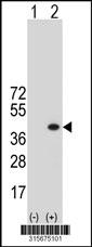 Western blot analysis of his-tag NUP43 (arrow) using his tag antibody. 293 cell lysates (2 ug/lane) either nontransfected (Lane 2) or transiently transfected with theNUP43 gene