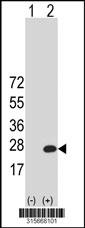 Western blot analysis of his-tag CNPY2 (arrow) using his tag antibody. 293 cell lysates (2 ug/lane) either nontransfected (Lane 2) or transiently transfected with theCNPY2 gene