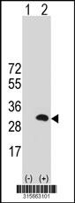 Western blot analysis of his-tag GRAP (arrow) using his tag antibody. 293 cell lysates (2 ug/lane) either nontransfected (Lane 2) or transiently transfected with theGRAP gene
