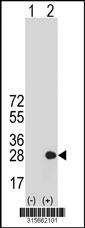 Western blot analysis of his-tag CXorf40A (arrow) using his tag antibody. 293 cell lysates (2 ug/lane) either nontransfected (Lane 2) or transiently transfected with theCXorf40A gene