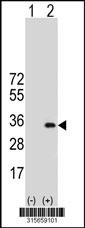Western blot analysis of his-tag C3orf62 (arrow) using his tag antibody. 293 cell lysates (2 ug/lane) either nontransfected (Lane 2) or transiently transfected with theC3orf62 gene