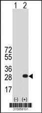 Western blot analysis of his-tag CSDC2 (arrow) using his tag antibody. 293 cell lysates (2 ug/lane) either nontransfected (Lane 2) or transiently transfected with theCSDC2 gene