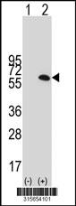 Western blot analysis of his-tag STAU1 (arrow) using his tag antibody. 293 cell lysates (2 ug/lane) either nontransfected (Lane 2) or transiently transfected with theSTAU1 gene
