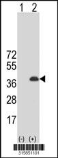 Western blot analysis of his-tag CBX7 (arrow) using his tag antibody. 293 cell lysates (2 ug/lane) either nontransfected (Lane 2) or transiently transfected with theCBX7 gene
