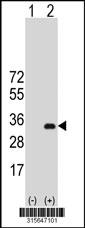 Western blot analysis of his-tag MBNL3 (arrow) using his tag antibody. 293 cell lysates (2 ug/lane) either nontransfected (Lane 2) or transiently transfected with theMBNL3 gene