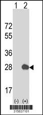 Western blot analysis of his-tag ZNF333 (arrow) using his tag antibody. 293 cell lysates (2 ug/lane) either nontransfected (Lane 2) or transiently transfected with theZNF333 gene