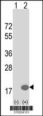 Western blot analysis of his-tag RBP7 (arrow) using his tag antibody. 293 cell lysates (2 ug/lane) either nontransfected (Lane 2) or transiently transfected with theRBP7 gene