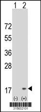 Western blot analysis of his-tag C19orf56 (arrow) using his tag antibody. 293 cell lysates (2 ug/lane) either nontransfected (Lane 2) or transiently transfected with theC19orf56 gene