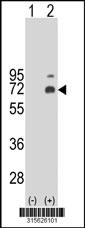 Western blot analysis of his-tag AMIGO1 (arrow) using his tag antibody. 293 cell lysates (2 ug/lane) either nontransfected (Lane 2) or transiently transfected with theAMIGO1 gene