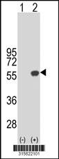 Western blot analysis of his-tag LDHD (arrow) using his tag antibody. 293 cell lysates (2 ug/lane) either nontransfected (Lane 2) or transiently transfected with theLDHD gene
