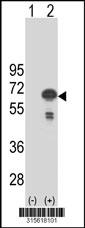 Western blot analysis of his-tag EHD4 (arrow) using his tag antibody. 293 cell lysates (2 ug/lane) either nontransfected (Lane 2) or transiently transfected with theEHD4 gene