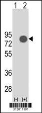 Western blot analysis of his-tag BIN2 (arrow) using his tag antibody. 293 cell lysates (2 ug/lane) either nontransfected (Lane 2) or transiently transfected with theBIN2 gene