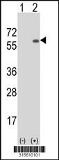 Western blot analysis of his-tag KLF17 (arrow) using his tag antibody. 293 cell lysates (2 ug/lane) either nontransfected (Lane 2) or transiently transfected with theKLF17 gene