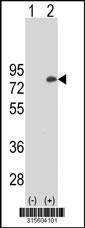 Western blot analysis of his-tag FOXP4 (arrow) using his tag antibody. 293 cell lysates (2 ug/lane) either nontransfected (Lane 2) or transiently transfected with theFOXP4 gene