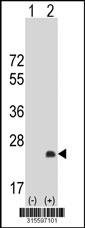 Western blot analysis of his-tag RPAIN (arrow) using his tag antibody. 293 cell lysates (2 ug/lane) either nontransfected (Lane 2) or transiently transfected with theRPAIN gene