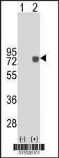 Western blot analysis of his-tag SFRS11 (arrow) using his tag antibody. 293 cell lysates (2 ug/lane) either nontransfected (Lane 2) or transiently transfected with theSFRS11 gene