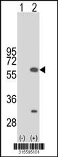 Western blot analysis of his-tag VPS4B (arrow) using his tag antibody. 293 cell lysates (2 ug/lane) either nontransfected (Lane 2) or transiently transfected with theVPS4B gene
