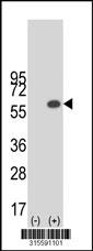 Western blot analysis of his-tag TUBA3D (arrow) using his tag antibody. 293 cell lysates (2 ug/lane) either nontransfected (Lane 2) or transiently transfected with theTUBA3D gene