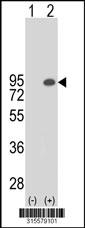 Western blot analysis of his-tag ZNF398 (arrow) using his tag antibody. 293 cell lysates (2 ug/lane) either nontransfected (Lane 2) or transiently transfected with theZNF398 gene